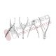 Posterior Cervical Fixation System Set