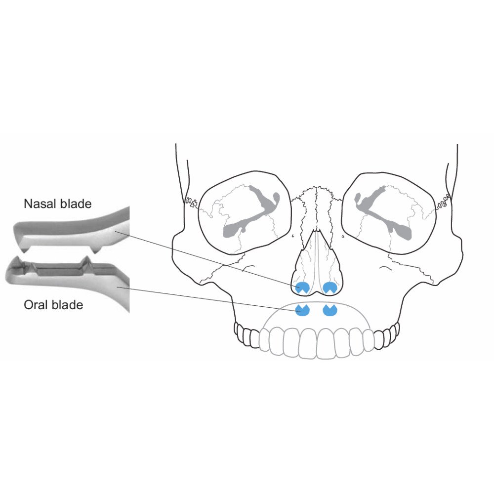 Disimpaction Forceps, Tessier-Rowe Forceps, 23cm/9", 40mm